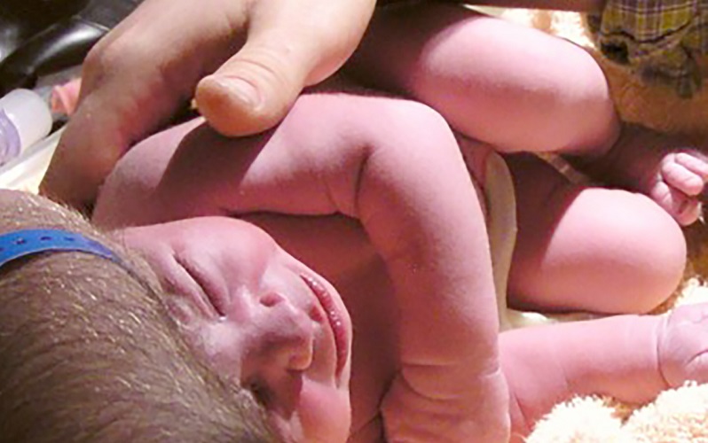 Suferința de a naște în România